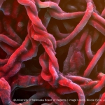 A close view of Methanobacterium nebraskense